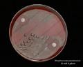 the optochin test with Streptococcus pneumoniae